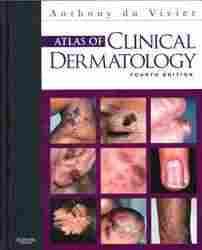 Atlas of Clinical Dermatology