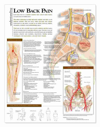 Understanding Low Back Pain Chart : Heavy Paper