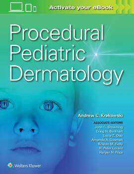 Procedural Pediatric Dermatology