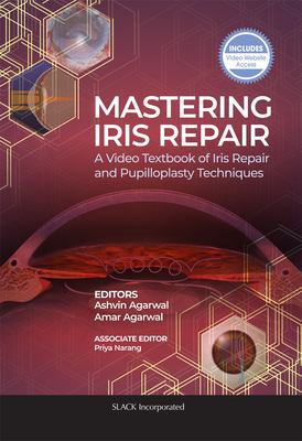 Mastering Iris Repair : A Video Textbook of Iris Repair and Pupilloplasty Techniques