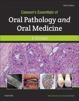 Cawson-s Essentials of Oral Pathology and Oral Medicine