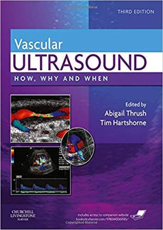 Vascular Ultrasound How Why and When