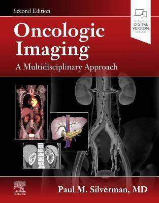 Oncologic Imaging : A Multidisciplinary Approach