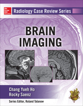 Radiology Case Review Series : Brain Imaging