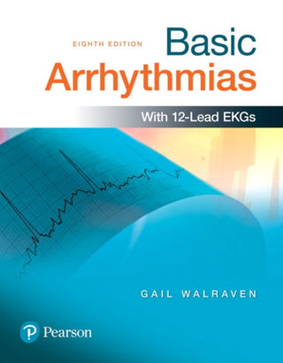 Basic Arrhythmias with 12 Lead EKGs