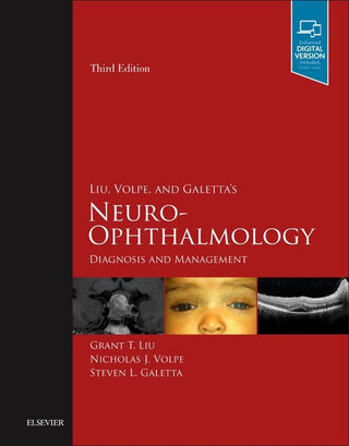 Liu Volpe and Galetta's Neuro-Ophthalmology : Diagnosis and Management