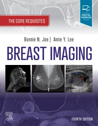 Breast Imaging : The Core Requisites