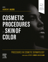 Cosmetic Procedures in Skin of Color