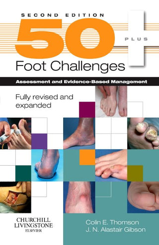 50+ Foot Challenges Assessment and Evidence Based Management