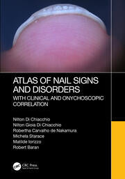 Atlas of Nail Signs and Disorders : with Clinical and Onychoscopic Correlation