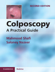 Colposcopy : A Practical Guide