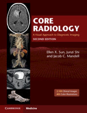 Core Radiology : A Visual Approach to Diagnostic Imaging