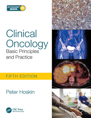 Clinical Oncology : Basic Principles and Practice