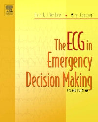 The ECG in Emergency Decision Making