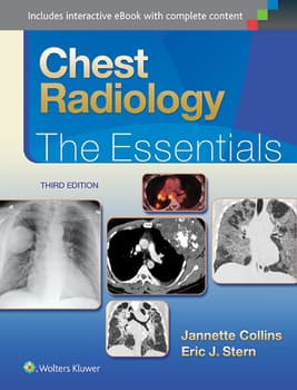 Chest Radiology : The Essentials