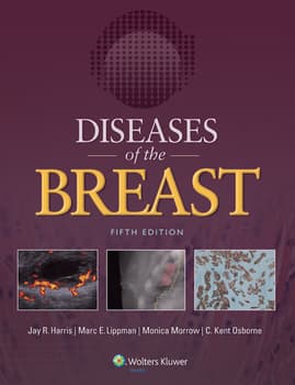 Diseases of the Breast