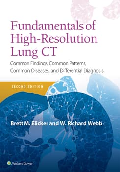 Fundamentals of High-Resolution Lung CT : Common Findings, Common Patterns, Common Diseases and Differential Diagnosis