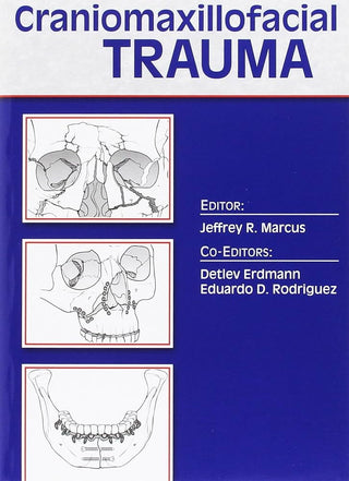 Essentials of Craniomaxillofacial Trauma