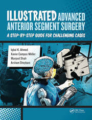 Illustrated Advanced Anterior Segment Surgery : A Step-By-Step Guide for Challenging Cases