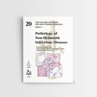 Haematolymphoid Tumours: Who Classification of Tumours ( WHO Classification of Tumours )