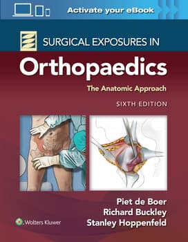 Surgical Exposures in Orthopaedics : The Anatomic Approach