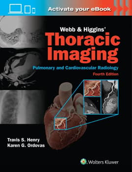 Webb & Higgins Thoracic Imaging