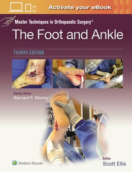 Foot and Ankle : Master Techniques in Orthopaedic Surgery