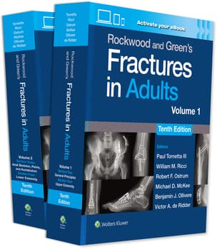 Rockwood and Green's Fractures in Adults : 2 Volumes