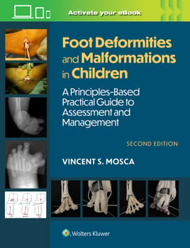 Foot Deformities and Malformations in Children : A Principles-Based, Practical Guide to Assessment and Management