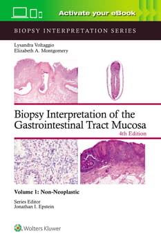 Biopsy Interpretation of the Gastrointestinal Tract Mucosa Volume 1 : Non-Neoplastic