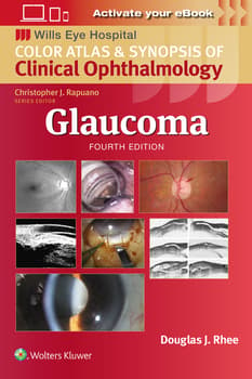 Glaucoma :  Color Atlas and Synopsis of Clinical Ophthalmology