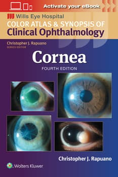 Cornea : Color Atlas and Synopsis of Clinical Ophthalmology