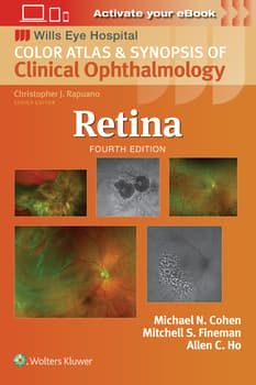 Retina :  Color Atlas and Synopsis of Clinical Ophthalmology