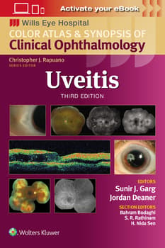 Uveitis : Color Atlas and Synopsis of Clinical Ophthalmology