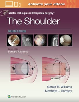 The Shoulder : Master Techniques in Orthopaedic Surgery
