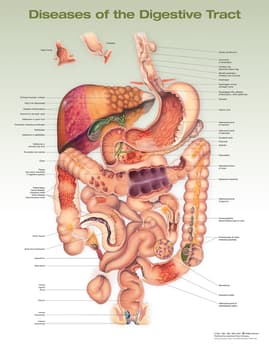 Diseases of the Digestive Tract