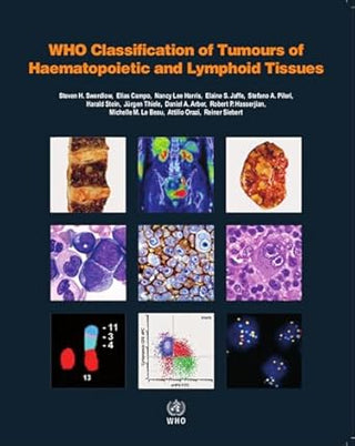 WHO Classification of Tumours of Haematopoietic and Lymphoid Tissues Vol 2