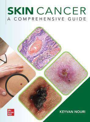 Skin Cancer : A Comprehensive Guide