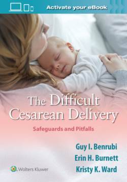 The Difficult Cesarean Delivery : Safeguards and Pitfalls