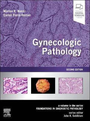 Gynecologic Pathology : A Volume in Foundations in Diagnostic Pathology Series