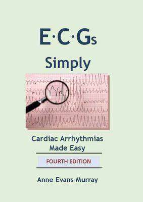 ECGs Simply : Cardiac Arrhythmias Made Easy