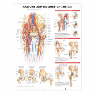 Anatomy and Injuries of the Hip Chart : Heavy Paper