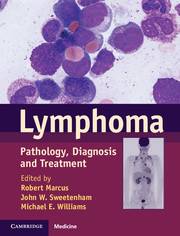 Lymphoma : Pathology Diagnosis and Treatment