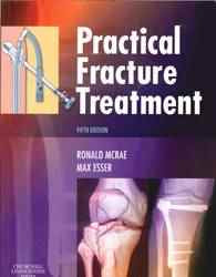 Practical Fracture Treatment