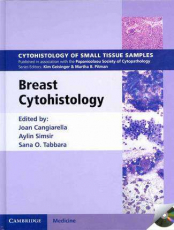Image of Breast Cytohistology